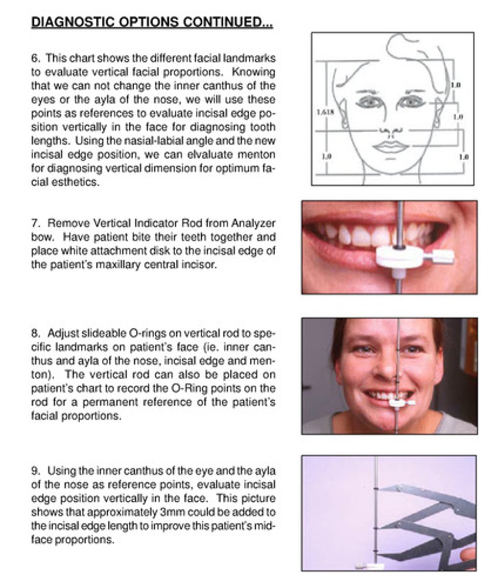 <p>1) the chart shows different facial landmarks to evaluate vertical facial proportions</p><p>2) we cant change inner canthus of eyes or ayla of nose —&gt; use as references to evaluate incisal edges position vertically in face for diagnosing tooth lengths</p><p>3) use nasal-labial angle and new incisal edge position —&gt; can use menton (lowest point of chin) to diagnose vertical dimension for optimum facial esthetics</p><p>4) remove vertical indicator rod from analyzer bow —&gt; have pt bite teeth together and place white attachment disk to incisal edge of max central incisor</p><p>5) adjust slideable o-rings on vertical rod to specific landmarks (inner canthus, ayla of nose, incisal edge, and menton); vertical rod can also be placed on pt's chart to record o-ring points on rod for permanent reference of pt's facial proportions</p><p>7) use inner canthus and ayla as reference points —&gt; evaluate incisal edge position vertically in face; picture shows that ~3mm could be added to incisal length to improve mid face proportion</p>