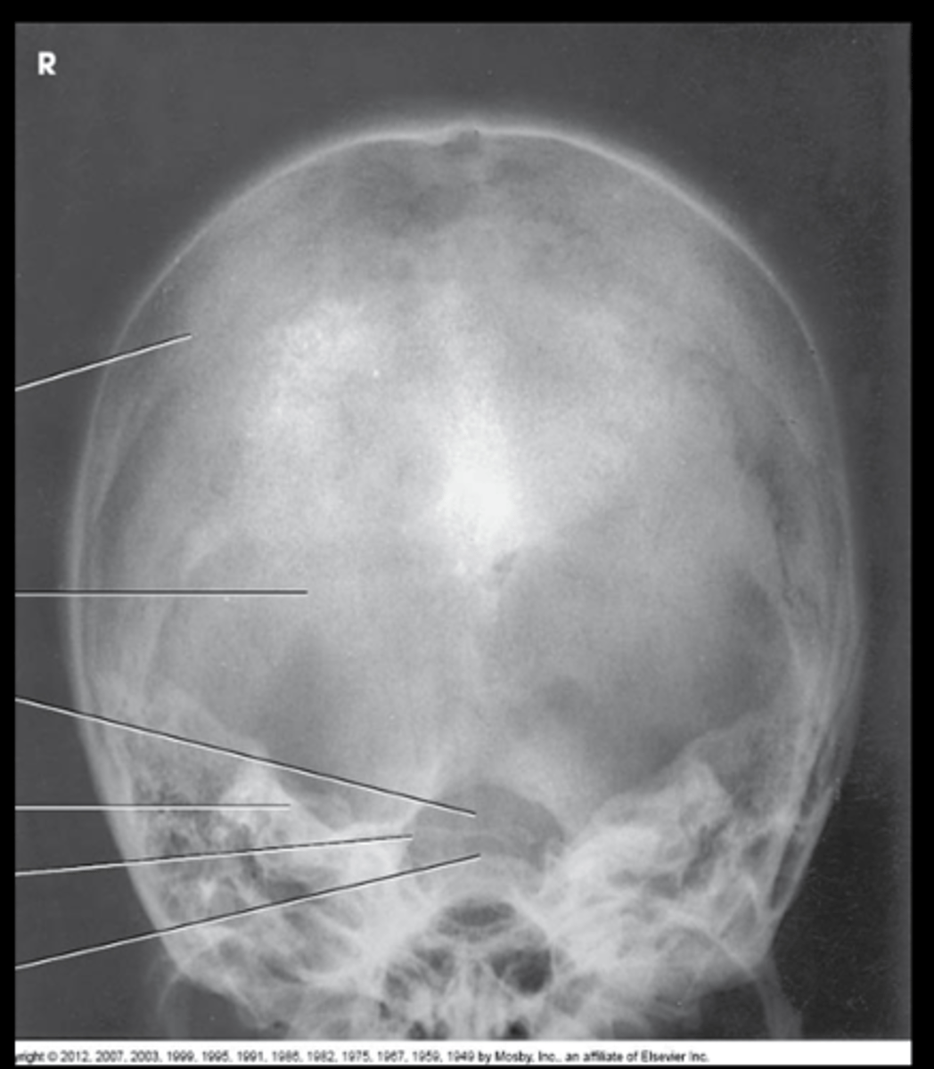 <p>What is the evaluation criteria for this image?</p>