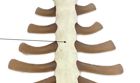 <p>What is thin middle part of the sternum?</p>