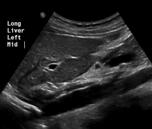 <p>In this sagittal plane, what is this structure?</p>