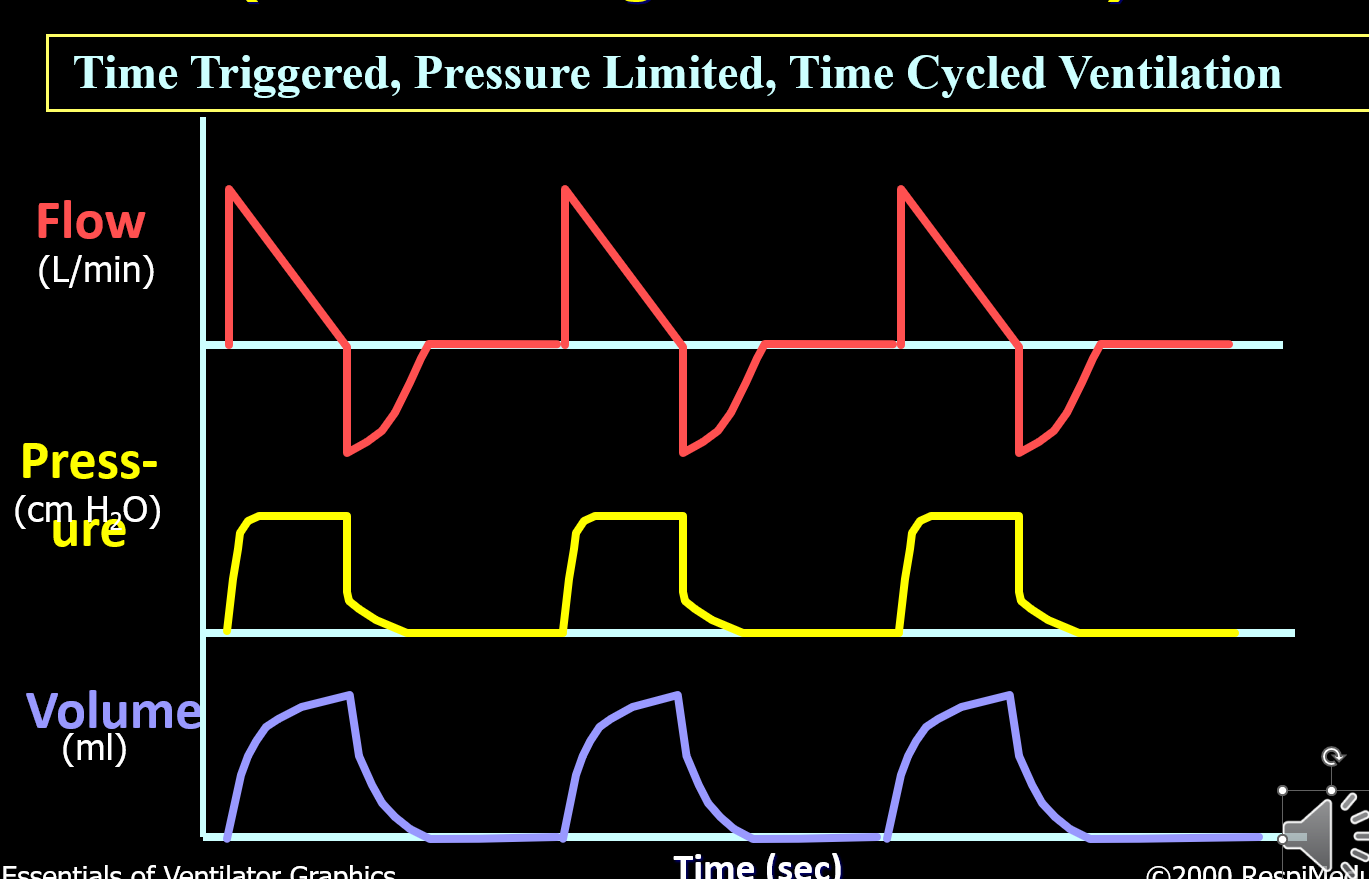 <p>What mode is this?</p>