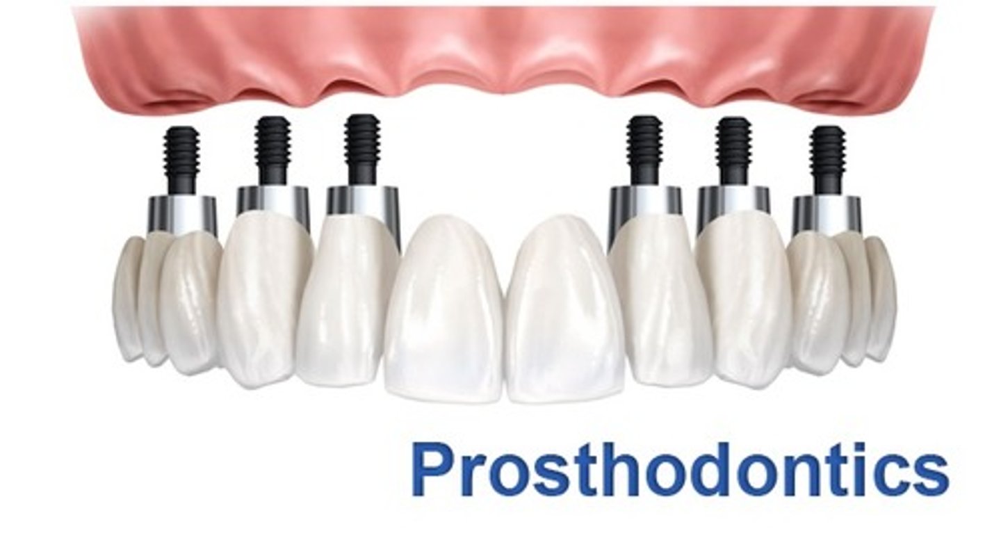 <p>replacement of missing teeth and oral structures with artificial substitutes.</p>