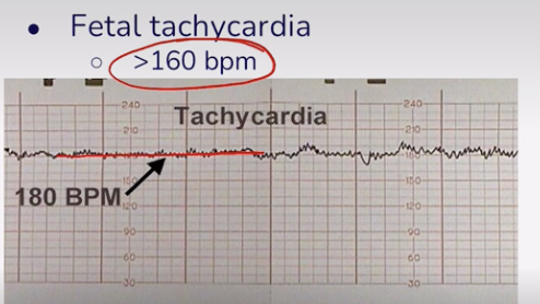 <p>More than 160 BPM</p>