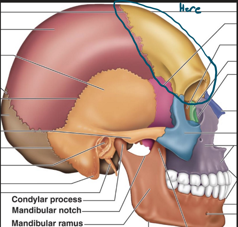 <p>Yellow part</p>