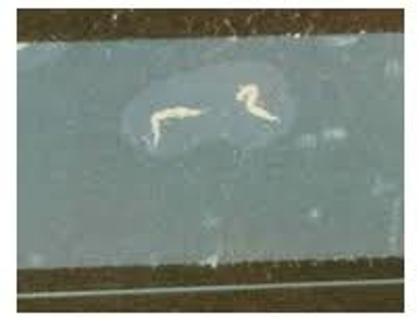 <p>Ova &amp; parasite is the best test, but the tape test can also be done &amp; usually works pretty well</p>