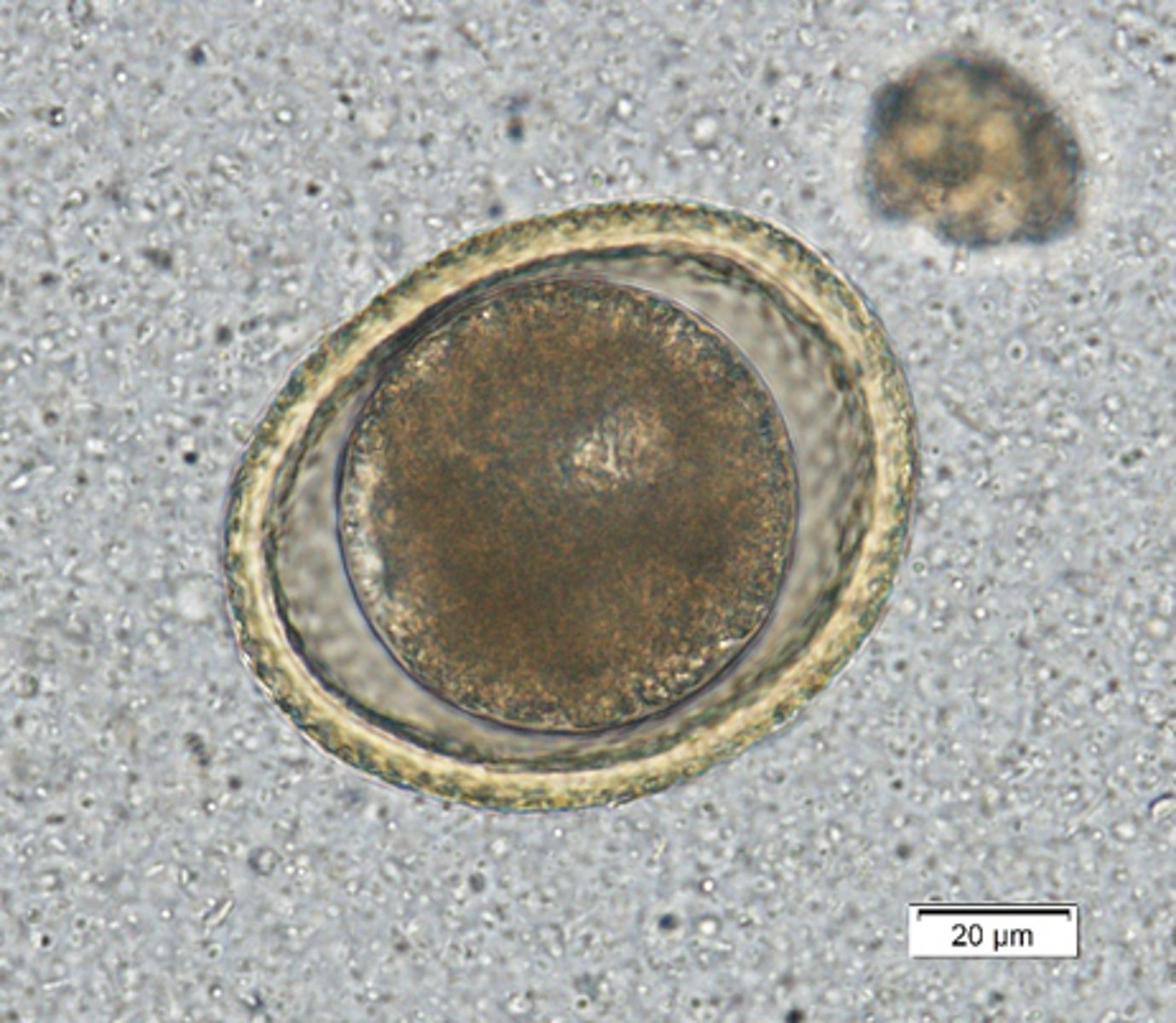<p>What is this parasite is this if it is from a dog</p>