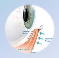 <p>Oil glands along the edge of the eyelids</p>