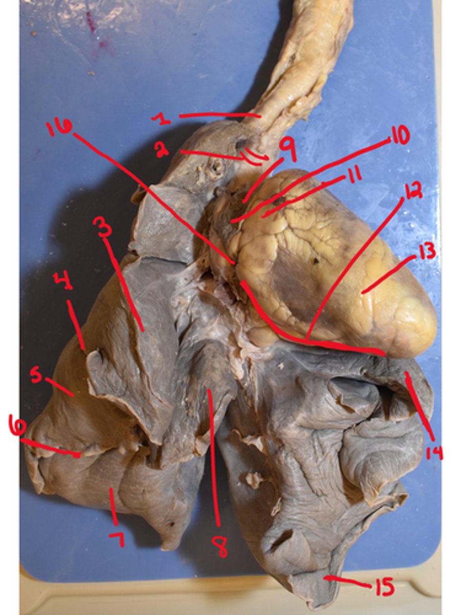 <p>What is structure #13</p>