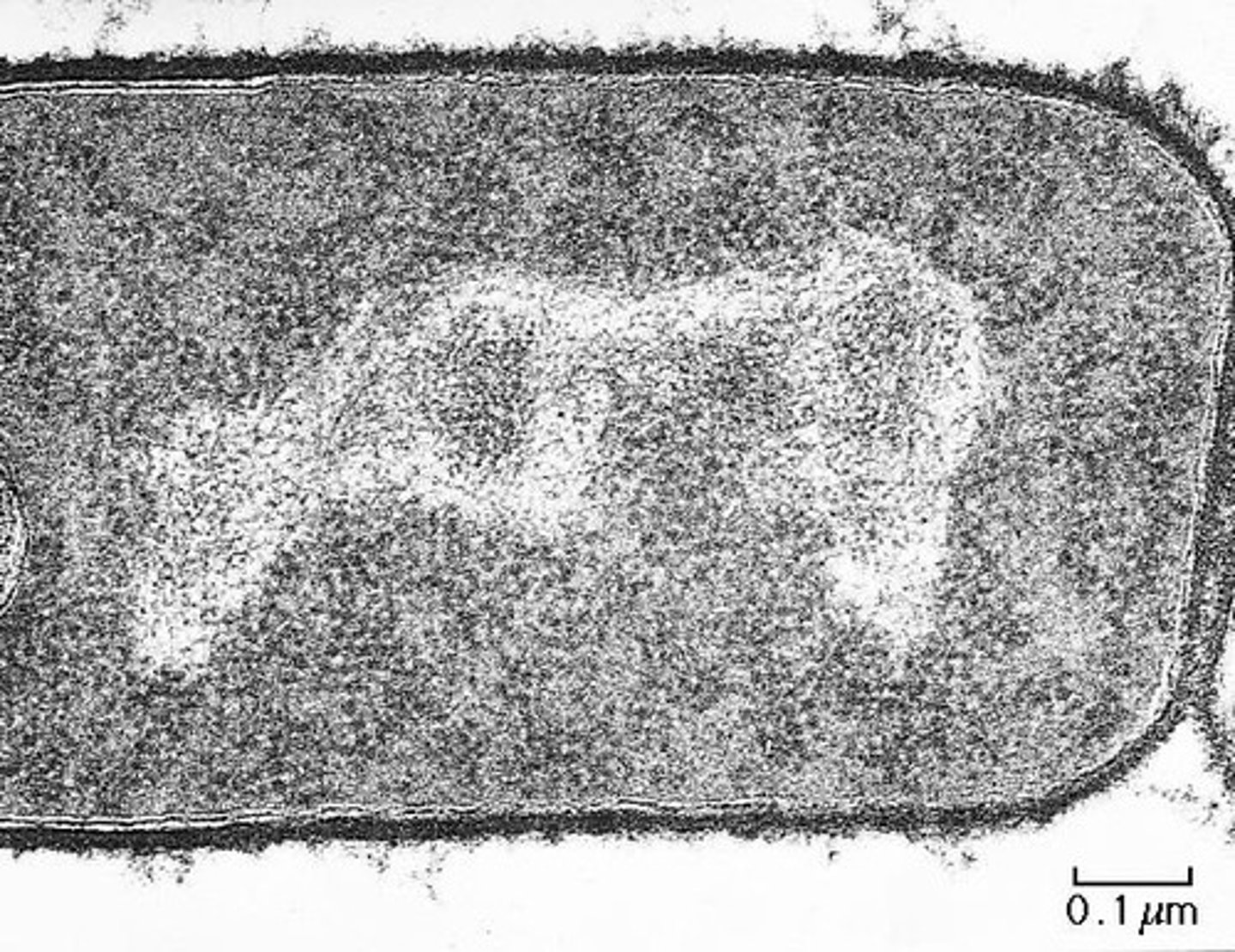 <p>The region in a prokaryotic cell where the genetic material is located.</p>