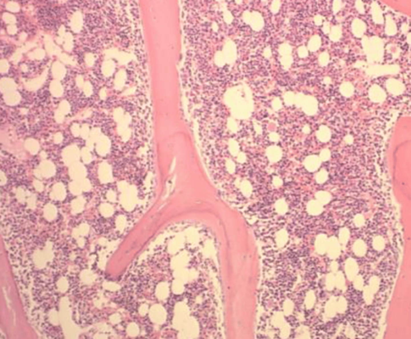 <p>- Biopsy (There is cellularity, a "big - picture", and architecture.</p>