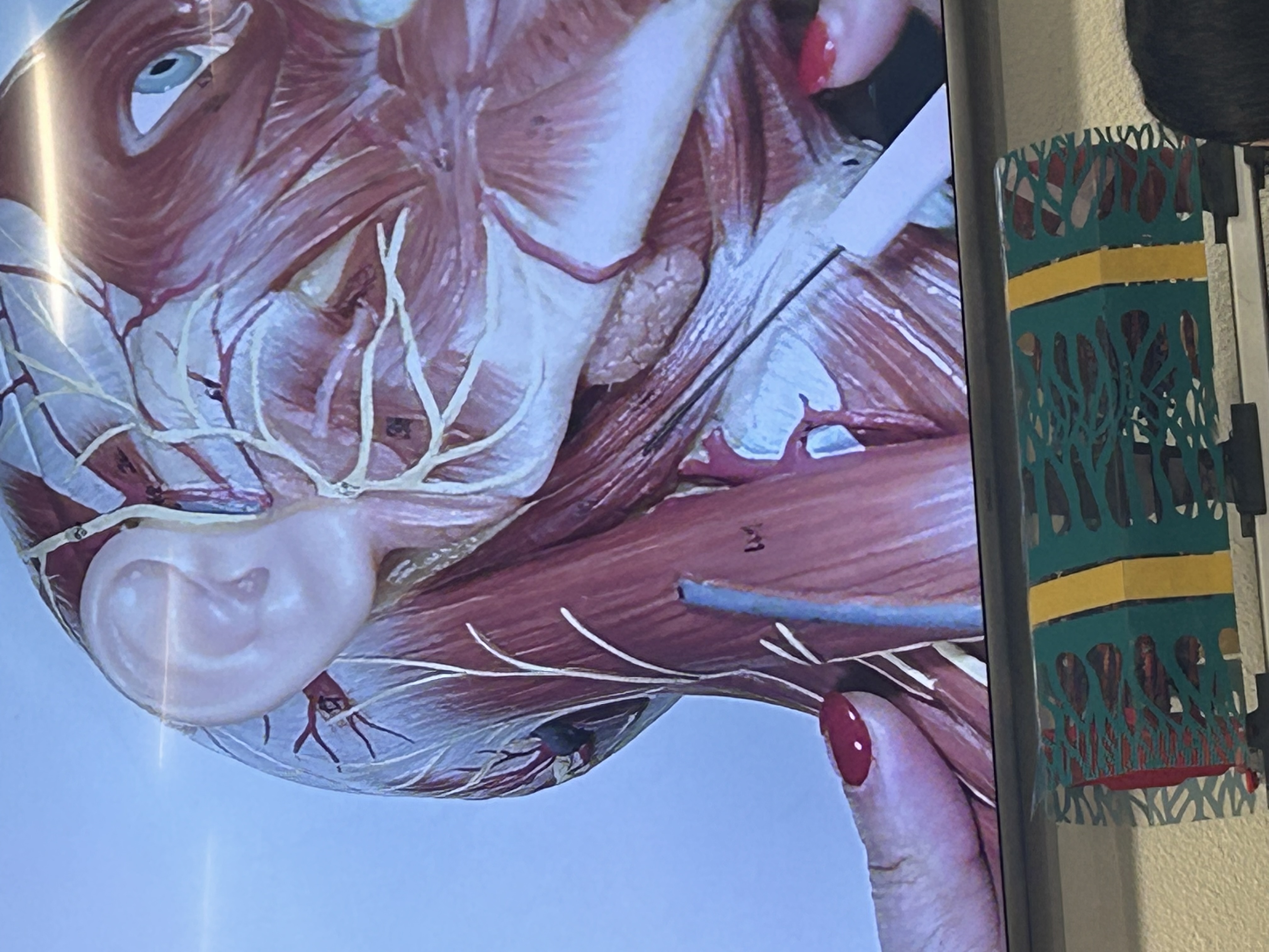 <p>What muscle is this?</p>
