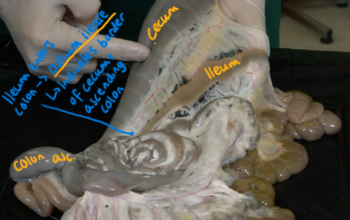 <p>The position of <strong>cecum?</strong></p>