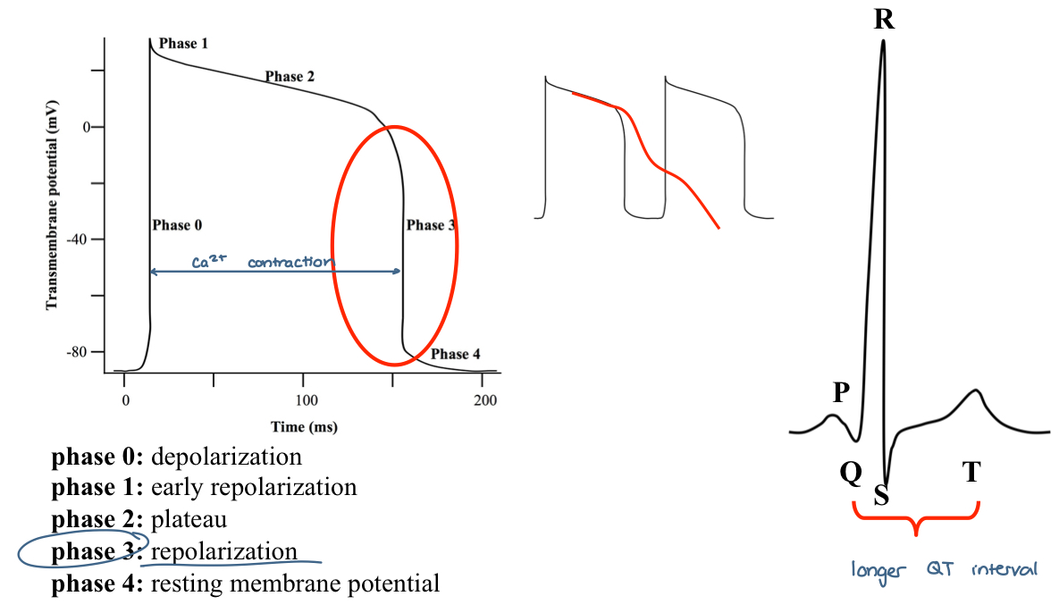 <p>when phase 3 repolarization is prolonged, polymorphic ventricular tachycardia with a long QT interval may ocur</p><ul><li><p>this is known as the&nbsp;<strong><em>tornadoes de pointes</em></strong>&nbsp;syndrome</p></li></ul><p></p>
