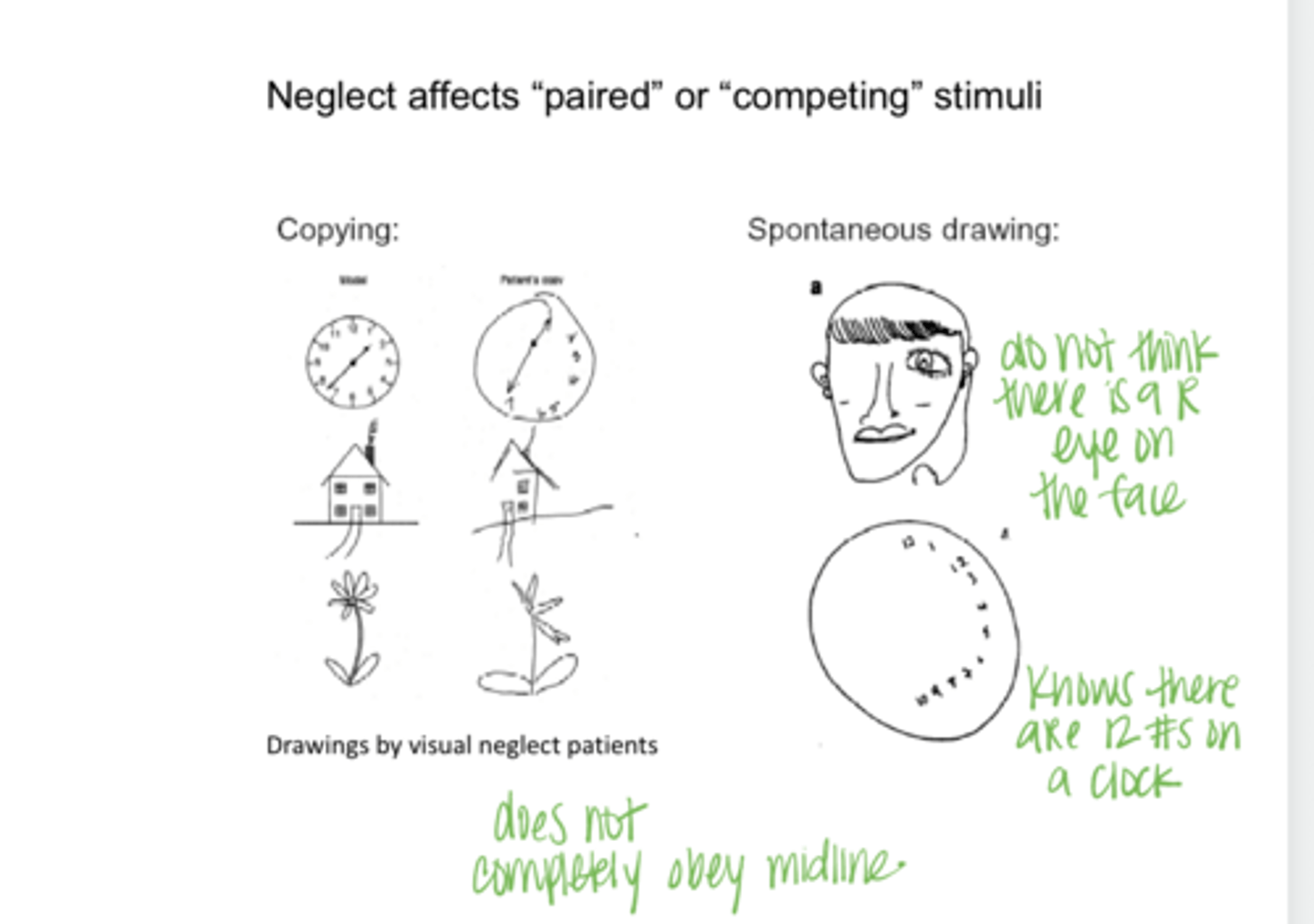 <p>Neglect Affects Paired or Competing Stimuli -- Copy v Spontaneous Drawing (Pic)</p>
