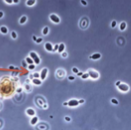 <p>large oval/round cells that reproduce by budding</p>