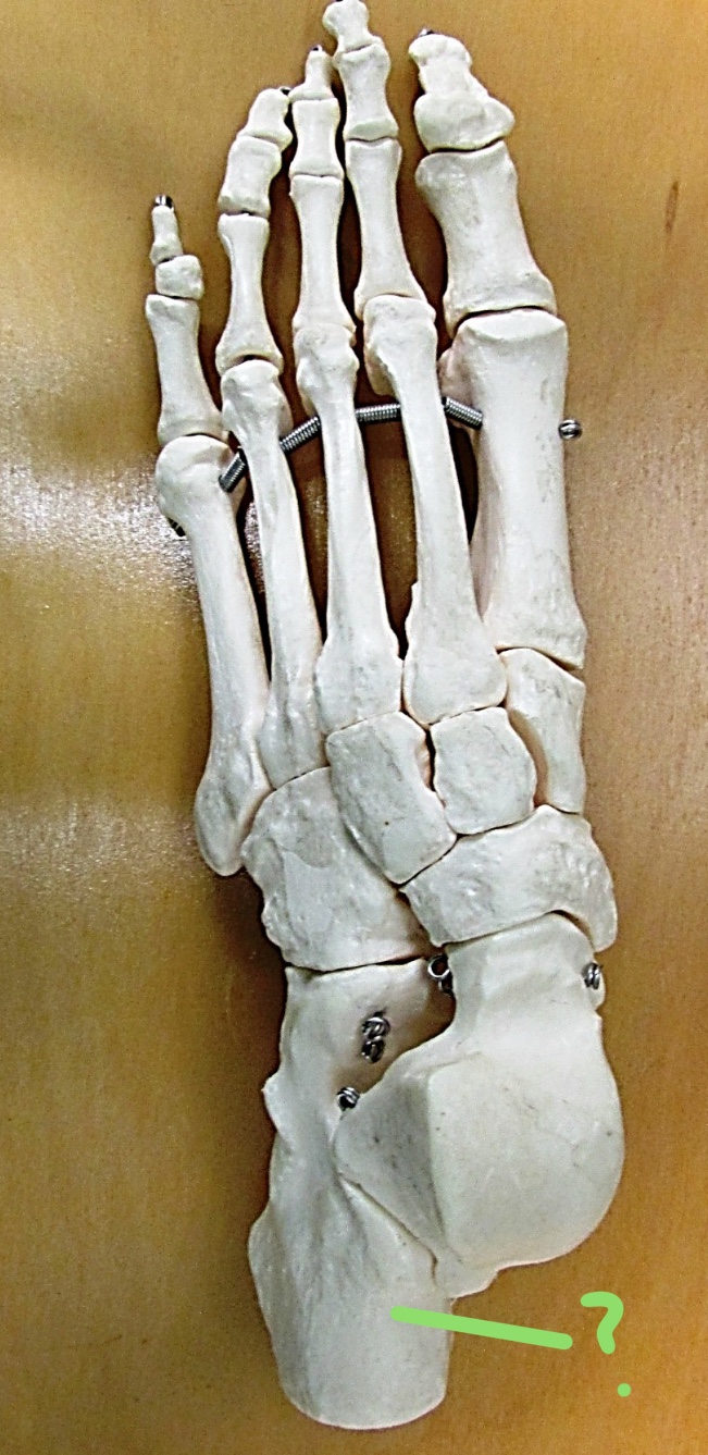 <p>Determine the part of the Femur highlighted</p>