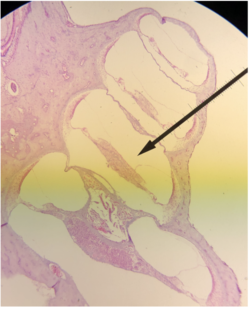 <p>In the image above, identify the main structure seen in the field of view.&nbsp;</p>