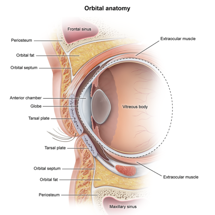 <p>Orbital vs Preseptal Cellulitis</p>