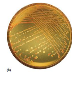 <p><span> diluted liquid sample containing microorganisms is spread evenly across the surface of a solid agar medium to create isolated, countable colonies </span></p>
