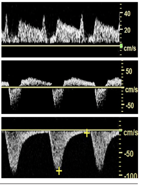 <p>What do these waveforms represent</p>