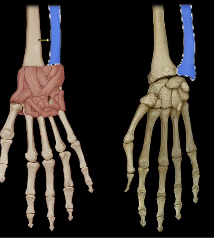 <p>Ulna</p>