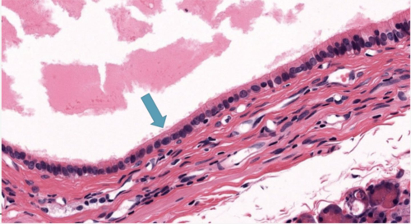 <p>Identify the type of epithelia</p>