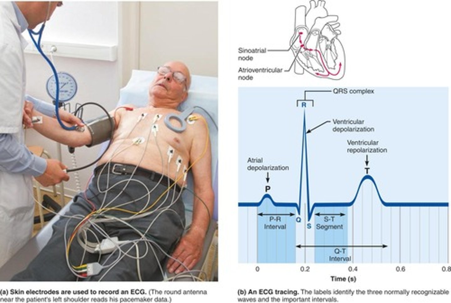 <p>A graphic recording of the heart's electrical activity, representing the composite of all action potentials at a given time.</p>