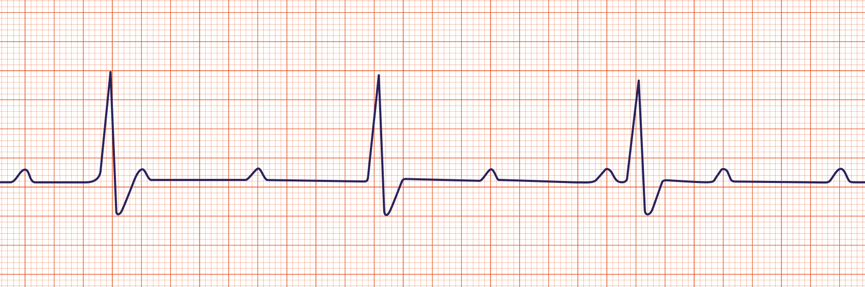 <p>What Rhythm is This?</p>