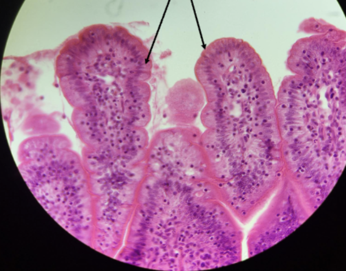 <ol><li><p><strong>Name this tissue type</strong></p></li><li><p><strong>Name a location<br>where you can find this tissue in<br>the body.</strong></p></li></ol><p></p>