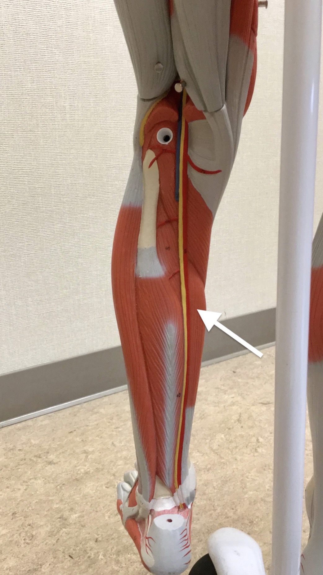 <p><span>Name the muscle labeled with the white arrow below:</span></p>