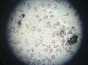 monocot stem