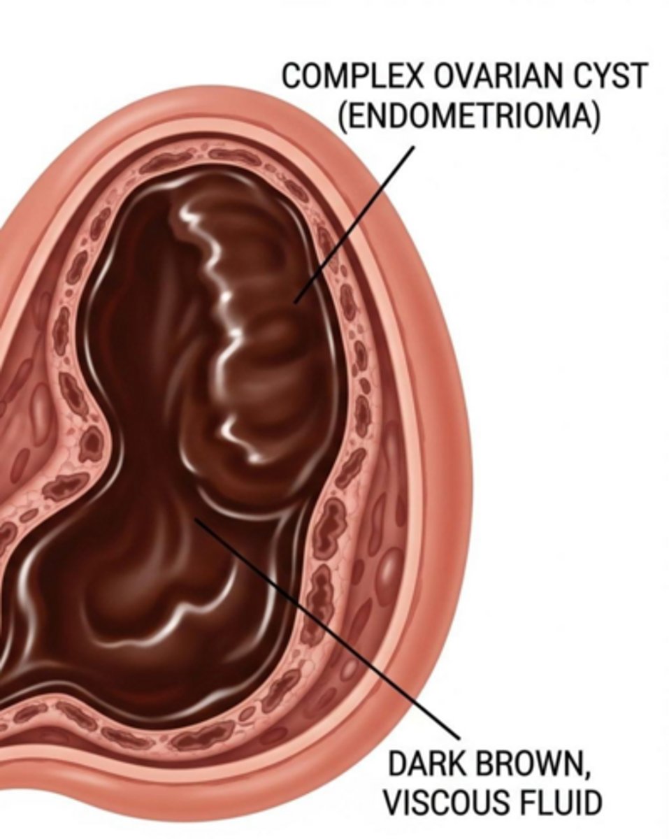 <p>Homogeneous internal 'ground-glass' echoes.</p>