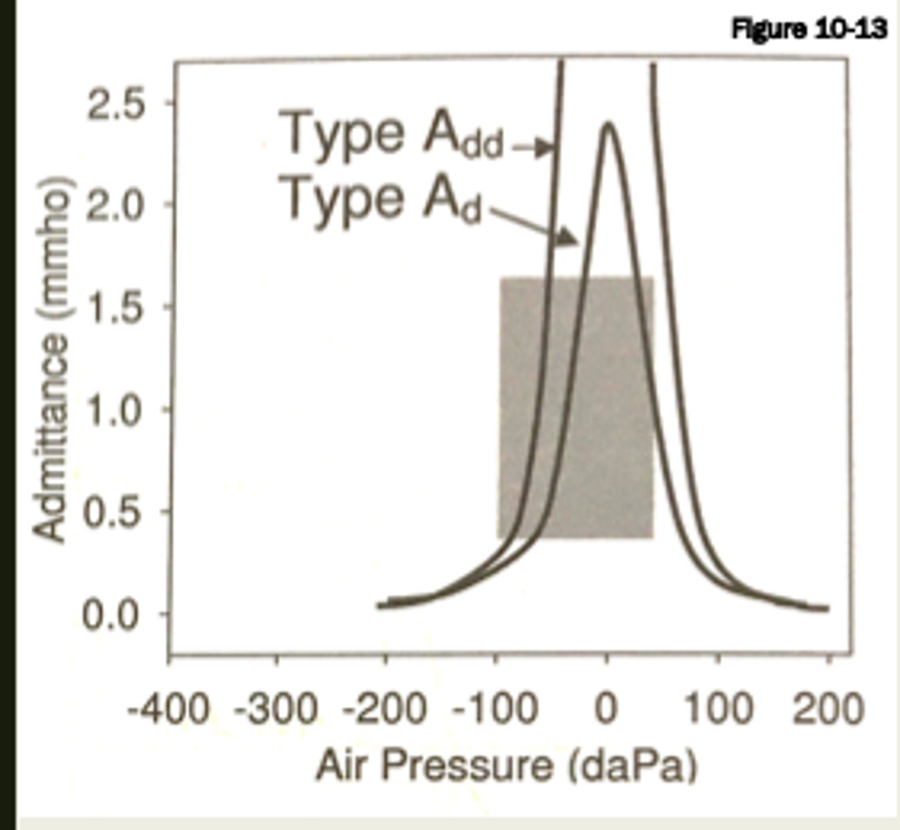 <p>Tymps similar to a typical ear, but the peak is extremely high. The middle ear system becomes too compliant, less stiff. Can be caused by ossicular chain discontinuity, an abnormal separation of the middle ear bones.</p>
