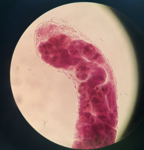 <p>second stage of larvae fasciola hepatica</p><p>elongated sac with mouth and simple digestive system</p><p>can feed on hosts tissue</p>