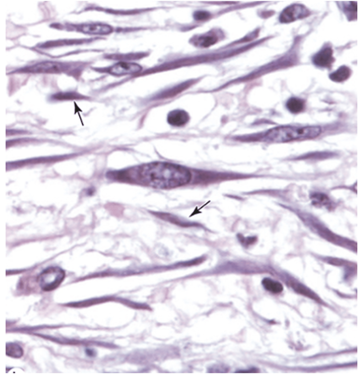 <p>What is the shape of fibrocytes</p>