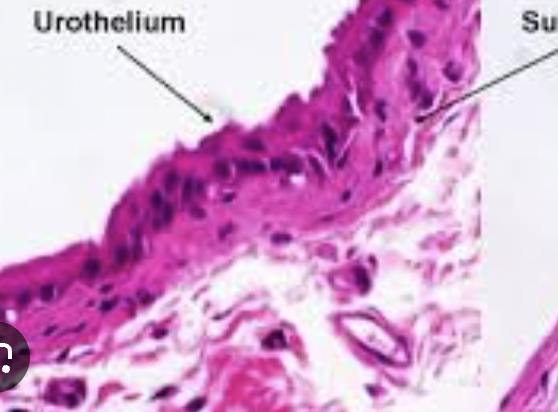 <p>-specialized<strong> <span>protective lining</span></strong><span> of the </span><strong><span>entire urinary tract</span></strong></p><p><span>-</span><strong><span>functions → preventing infection </span></strong><span>&</span><strong><span> sensory transduction of stimuli</span></strong></p><p><strong><span>-location → renal pelvis, ureters, urinary bladder, proximal part of urethra</span></strong></p><p><span>⭐</span><strong><mark data-color="#fffbd5" style="background-color: rgb(255, 251, 213); color: inherit;"><span>️allows bladder to expand and fill with urine</span></mark></strong></p>