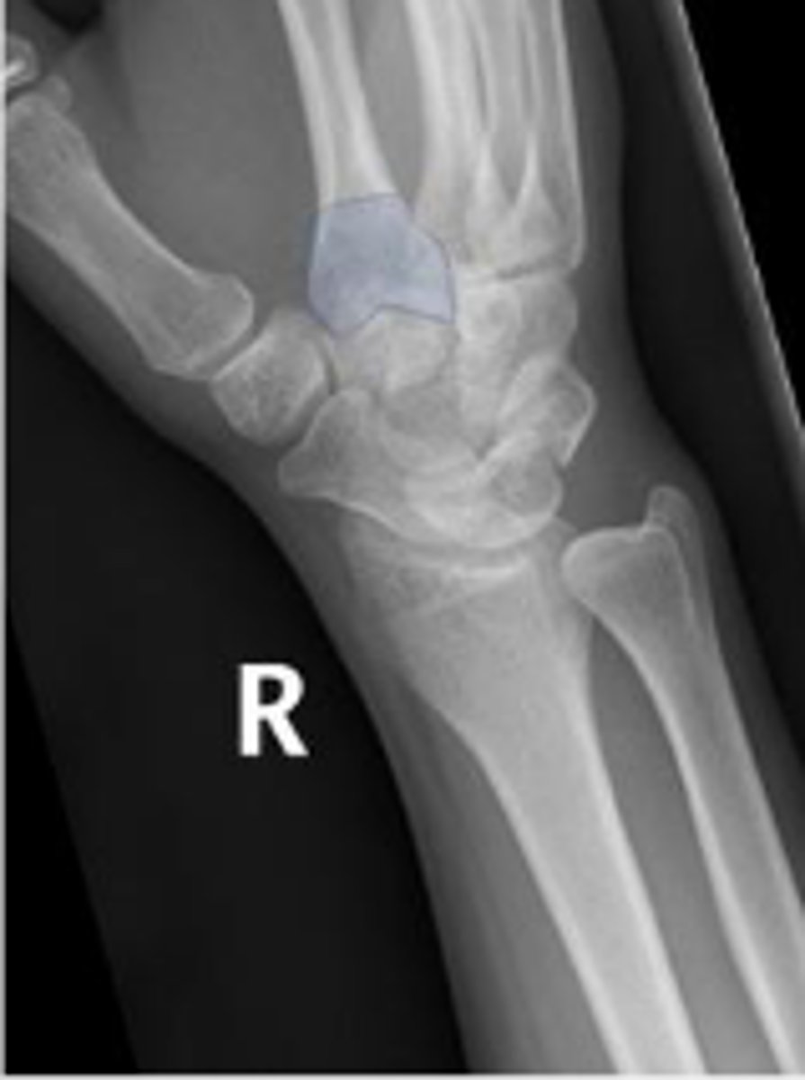 <p>What is the arrow pointing to?</p>