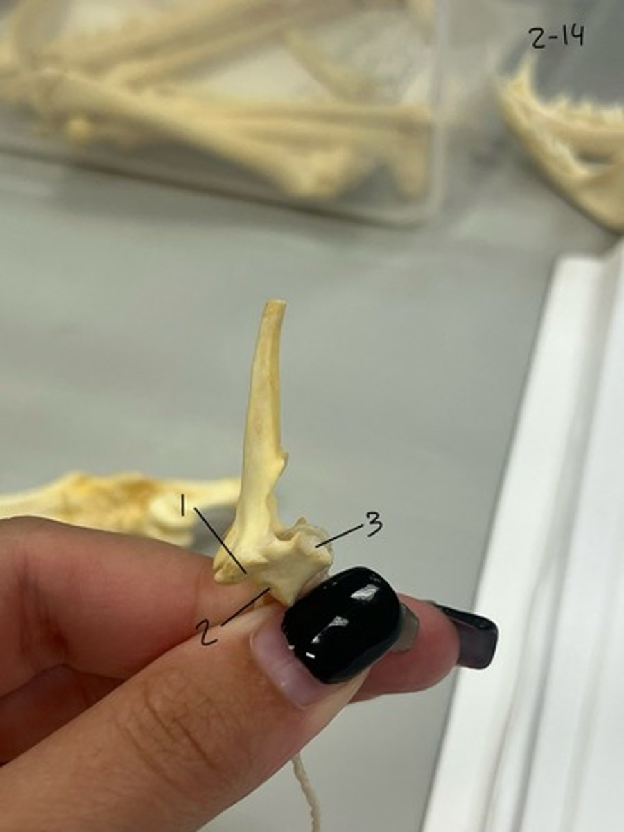 <p>Entire structure?</p>