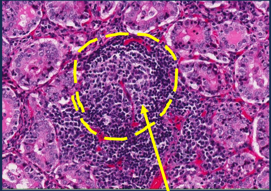 <p>What is the arrow pointing to?</p>