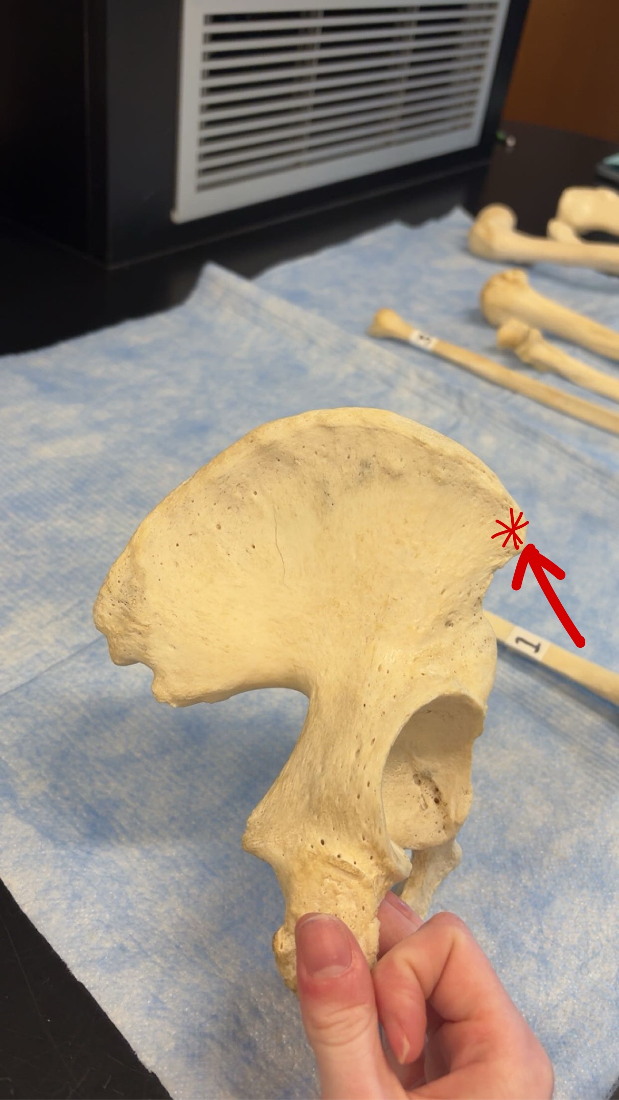 <p>Name this structure</p>