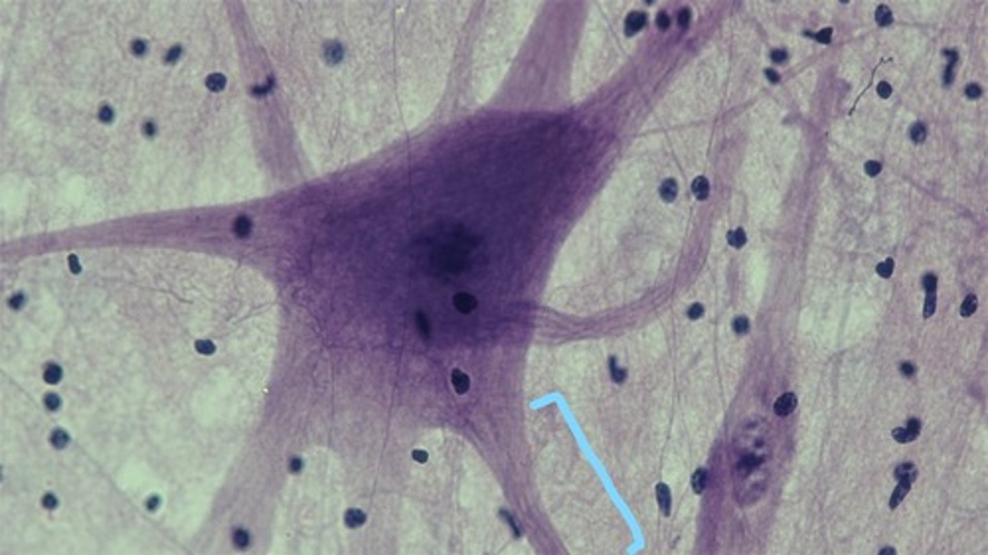 <p>the extension of a neuron, ending in branching terminal fibers, through which messages pass to other neurons or to muscles or glands</p>