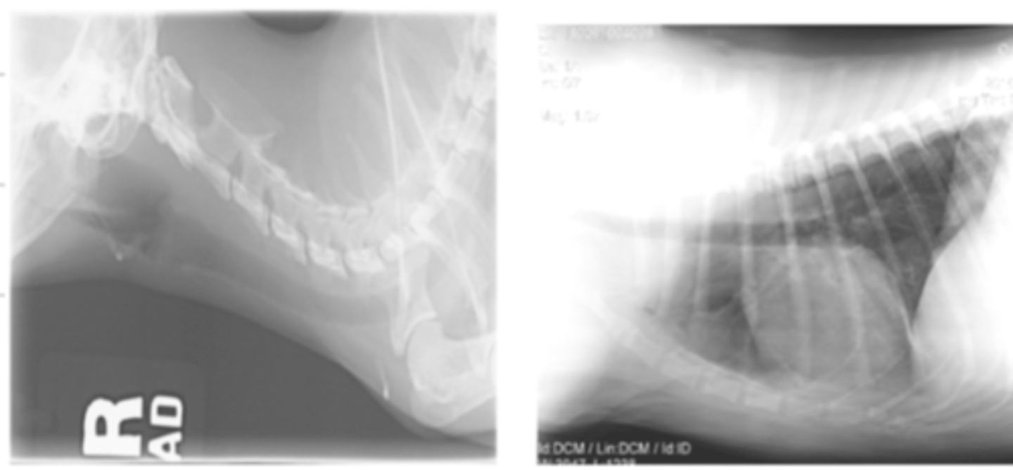 <p>when we use a kV that is too low, it will cause a bright film.</p>