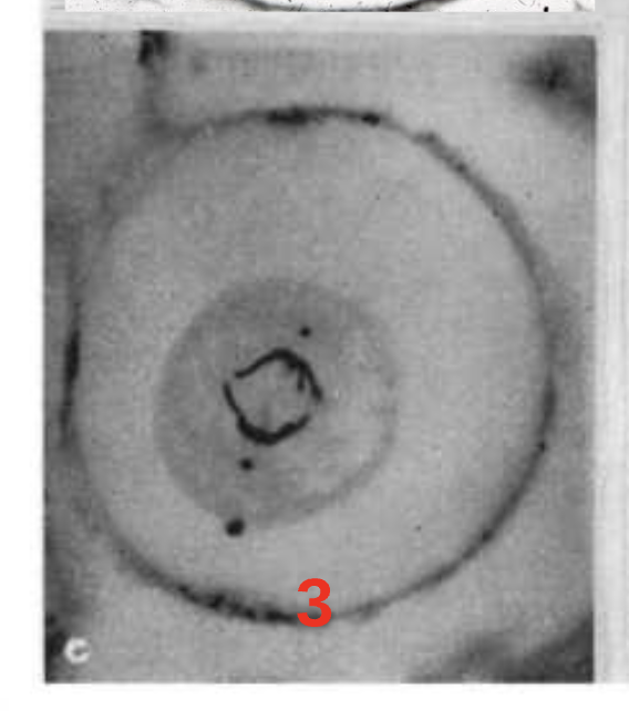 <p>Step 3.) Anaphase</p>