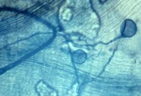 <p>mycorrhizae</p>
