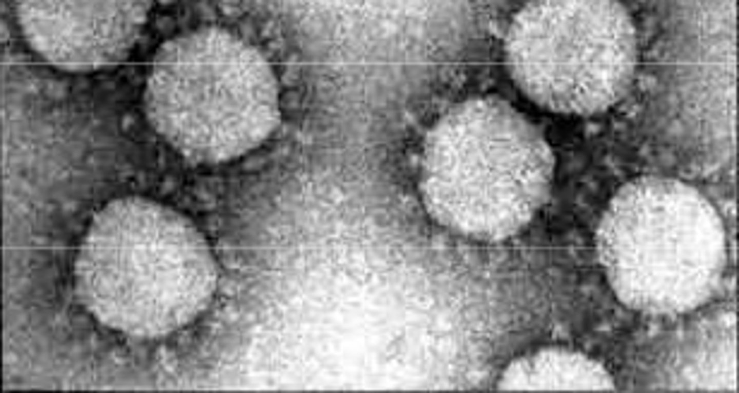 <p>Cold virus, flu, ebola</p>