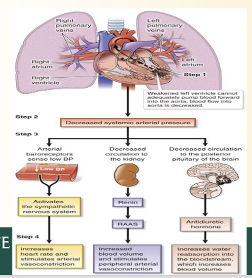 <p>Backward LVF = pulmonary congestion pathway</p><p>Forward LVF Steps</p><ul><li><p>Cant pump enough blood into aorta</p></li><li><p>Decreased systemic arterial pressure</p></li><li><p>Renin, ADH, and SNS stuff activate from earlier</p><ul><li><p>Causes fluid retention, increased BP, Incrase HR, Increase Vasoconstrict, etc.</p></li></ul></li></ul><p></p>