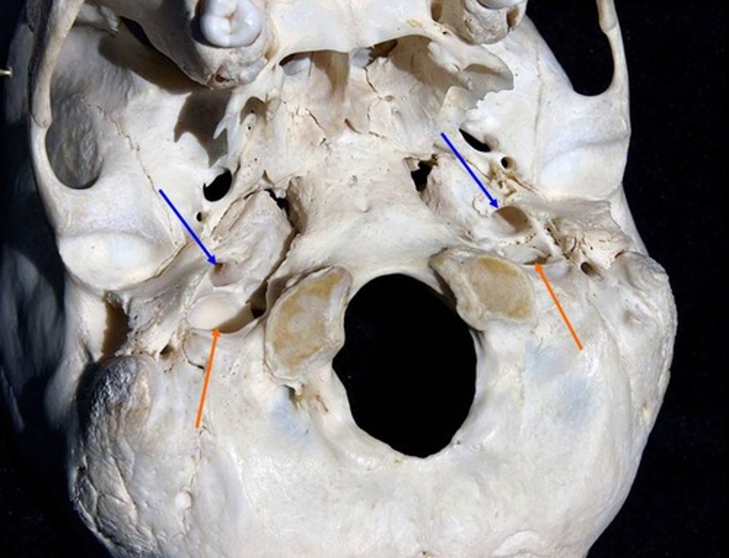 <p>What are the blue arrows pointing to?</p>