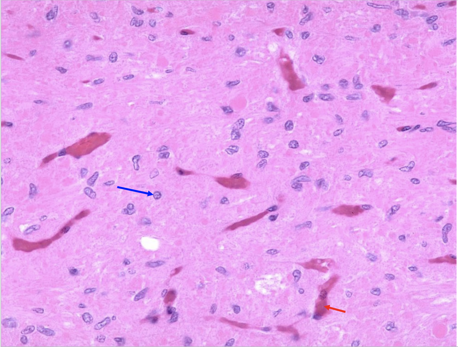 In this slide of the neurohypophysis, what does the blue arrow indicate?