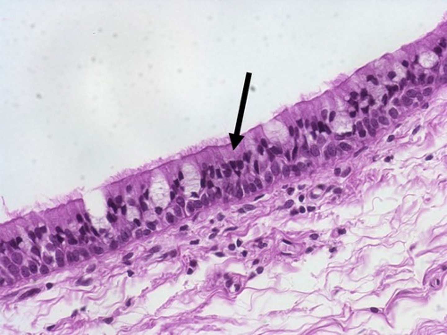 <p>A single layer of tall cells that looks like many layers because their nuclei are at different levels; it has tiny hair-like cilia on top that help move mucus.</p>
