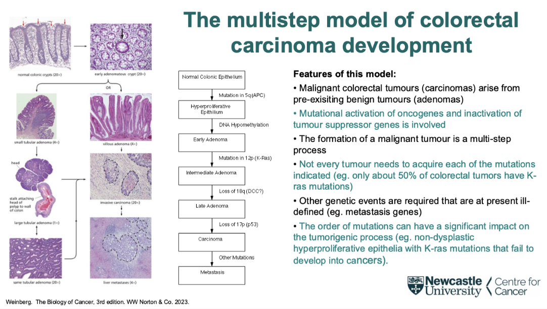 <p><span style="background-color: inherit; line-height: 22px; color: windowtext;"><span>Large range of stages of colorectal carcinoma</span></span><span style="line-height: 22px; color: windowtext;"><span>&nbsp;</span></span></p><p class="Paragraph SCXO147207450 BCX0" style="text-align: left;"><span style="background-color: inherit; line-height: 22px; color: windowtext;"><span>5-7 that can be readily biopsied</span></span><span style="line-height: 22px; color: windowtext;"><span>&nbsp;</span></span></p><ul><li><p class="Paragraph SCXO147207450 BCX0" style="text-align: left;"><span style="background-color: inherit; line-height: 22px; color: windowtext;"><span>Each stage- different type of mutation involved</span></span><span style="line-height: 22px; color: windowtext;"><span>&nbsp;</span></span></p></li><li><p class="Paragraph SCXO147207450 BCX0" style="text-align: left;"><span style="background-color: inherit; line-height: 22px; color: windowtext;"><span>Eg TS mutation early</span></span><span style="line-height: 22px; color: windowtext;"><span>&nbsp;</span></span></p></li><li><p class="Paragraph SCXO147207450 BCX0" style="text-align: left;"><span style="background-color: inherit; line-height: 22px; color: windowtext;"><span>P53 later&nbsp;</span></span><span style="line-height: 22px; color: windowtext;"><span>&nbsp;</span></span></p></li></ul><p class="Paragraph SCXO147207450 BCX0" style="text-align: left;"></p><p class="Paragraph SCXO147207450 BCX0" style="text-align: left;"><span style="background-color: inherit; line-height: 22px; color: windowtext;"><span>Shows you do ned multiple genes to be mutation in a given cancer</span></span><span style="line-height: 22px; color: windowtext;"><span>&nbsp;</span></span></p>